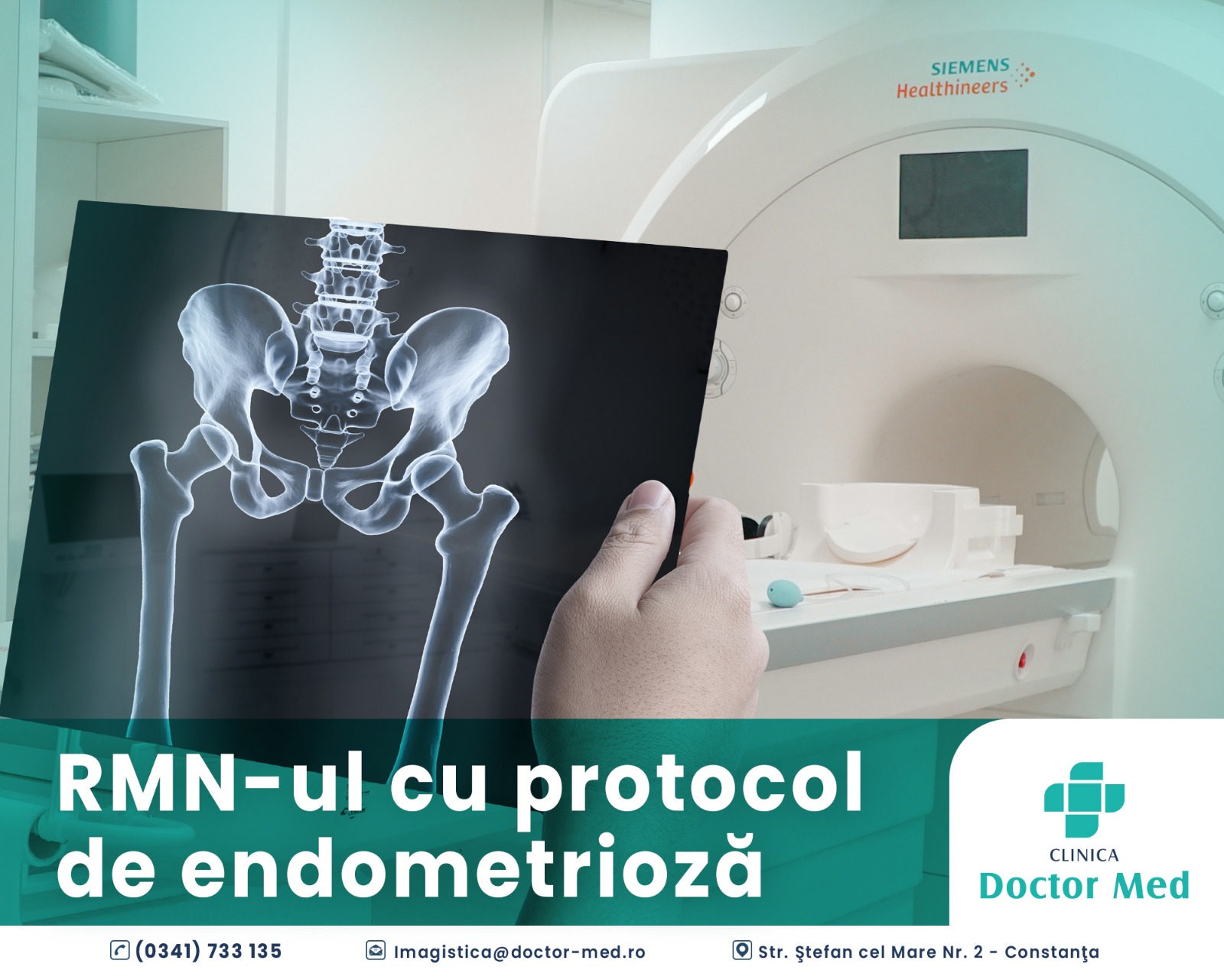 RMN-ul pelvin cu protocol de endometrioză